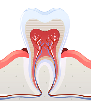 치은염(초기~ 중기)